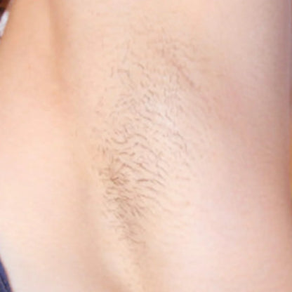 VelvetSkin Elixir | Natürlich glatte Haut. Dauerhaft schön.