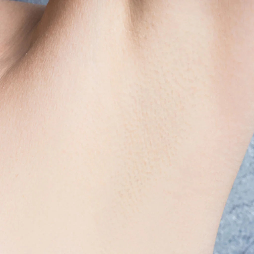 VelvetSkin Elixir | Natürlich glatte Haut. Dauerhaft schön.