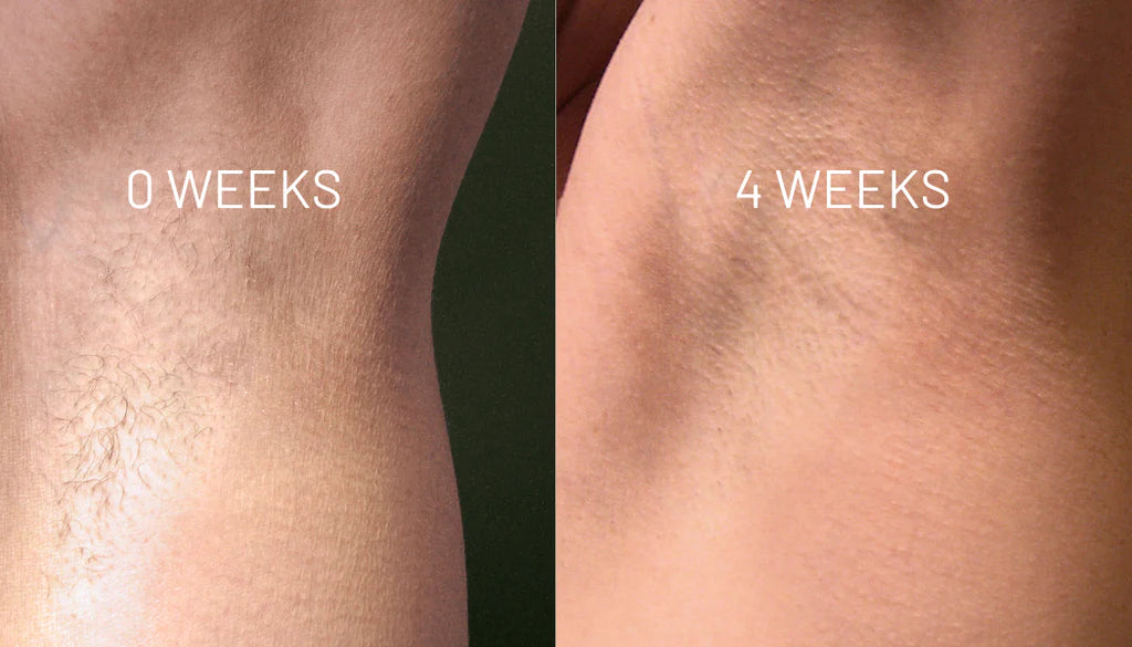 VelvetSkin Elixir | Natürlich glatte Haut. Dauerhaft schön.