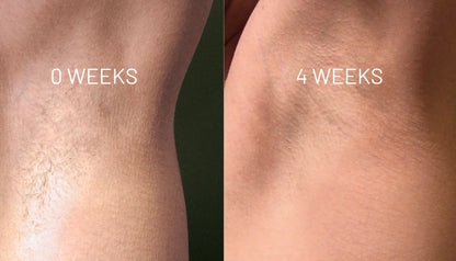 VelvetSkin Elixir | Natürlich glatte Haut. Dauerhaft schön.