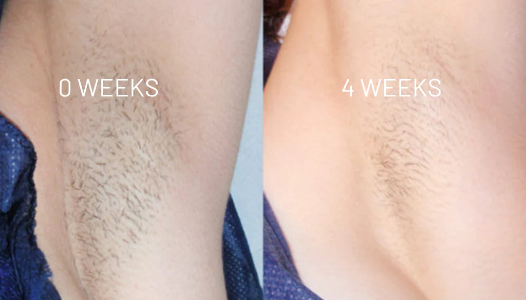 VelvetSkin Elixir | Natürlich glatte Haut. Dauerhaft schön.