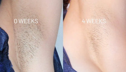 VelvetSkin Elixir | Natürlich glatte Haut. Dauerhaft schön.