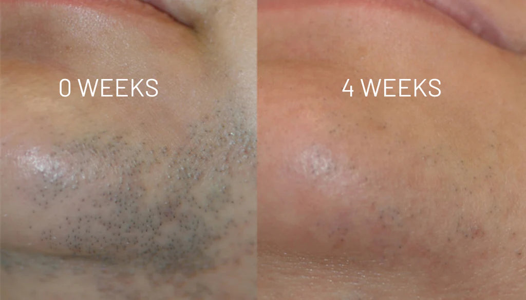 VelvetSkin Elixir | Natürlich glatte Haut. Dauerhaft schön.