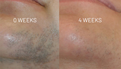 VelvetSkin Elixir | Natürlich glatte Haut. Dauerhaft schön.