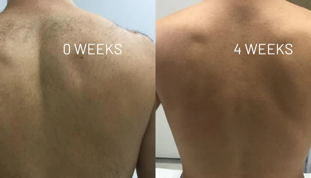 VelvetSkin Elixir | Natürlich glatte Haut. Dauerhaft schön.