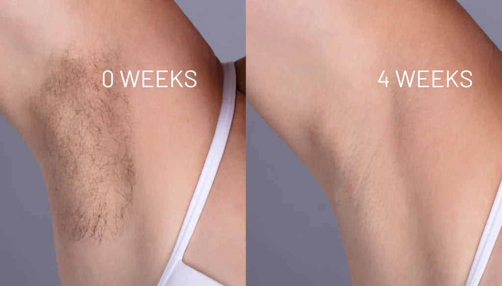 VelvetSkin Elixir | Natürlich glatte Haut. Dauerhaft schön.