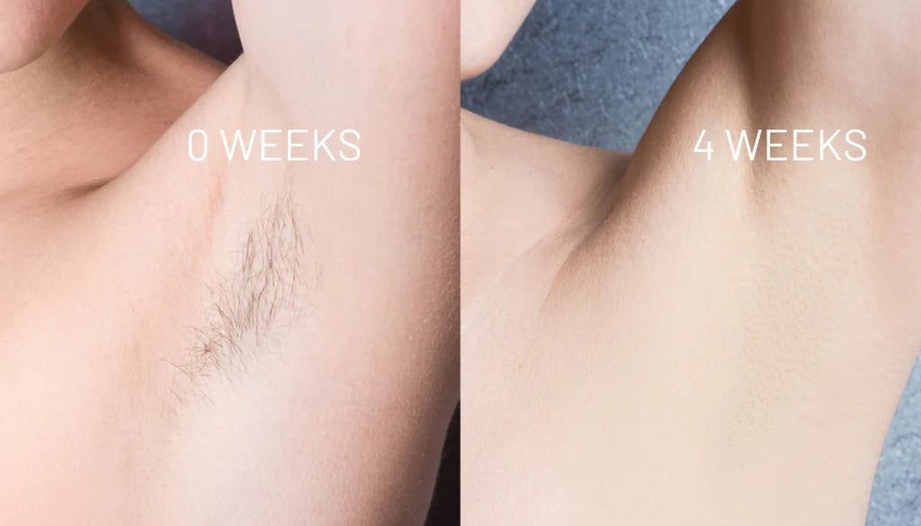 VelvetSkin Elixir | Natürlich glatte Haut. Dauerhaft schön.